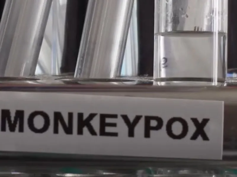Mengenal Monkeypox, Bermula Ditemukan di Monyet lalu Manusia